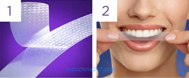 Miếng dán trắng răng dùng trong y tế nhập từ Mỹ